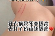 被猫咬伤出血，是否会得狂犬病？（如何判断猫抓伤是否感染狂犬病毒？）